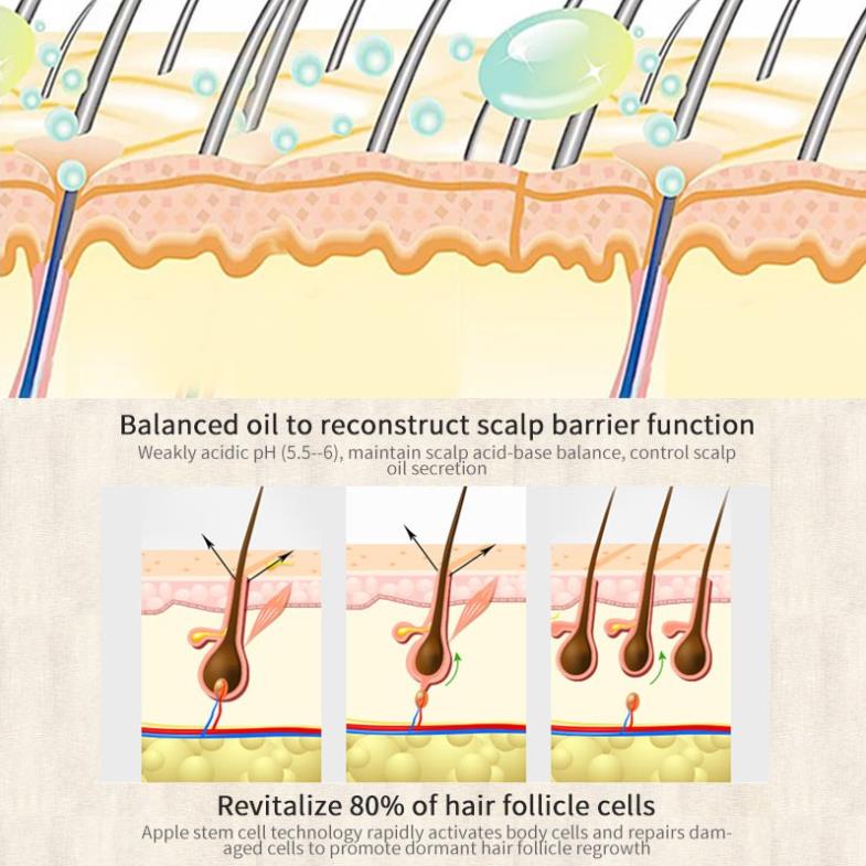 Tinh Chất Xịt Kích Mọc Tóc SEVICH Chiết Xuất Gừng Kháng Khuẩn 30ml
