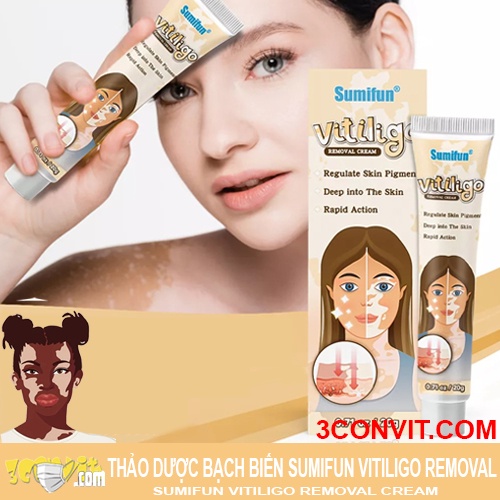 Thảo dược bôi bạch biến Sumifun Vitiligo Removal