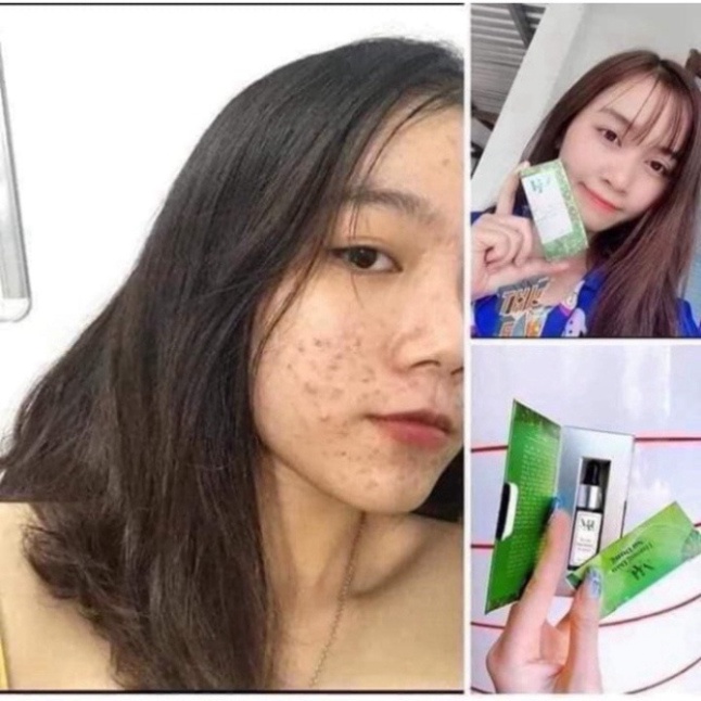 [HÀNG _AUTH] Thảo Dược Ngăn Ngừa, Sạch Mụn Dr Mai✅ | BigBuy360 - bigbuy360.vn