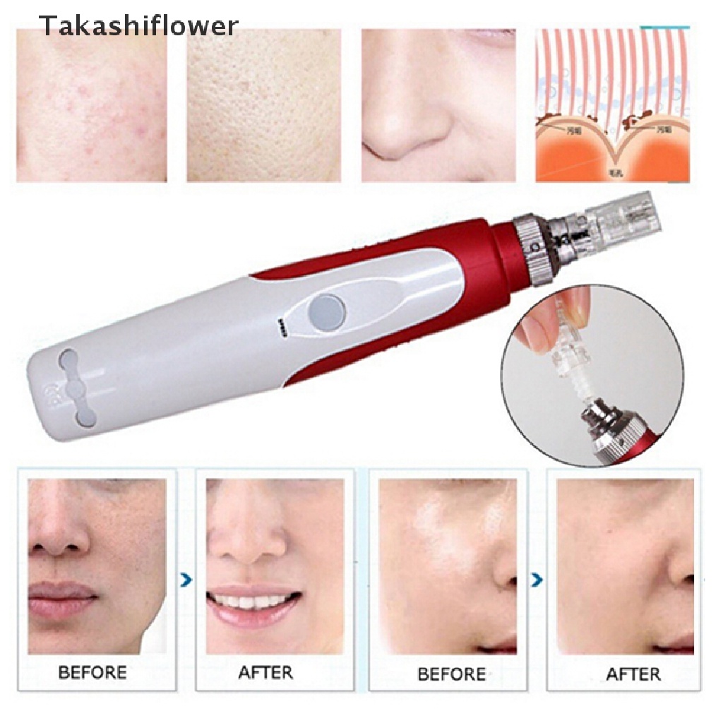 Bộ Kim Lăn Điện Với 2 Đầu Lăn Chống Lão Hóa Chăm Sóc Da Tiện Dụng