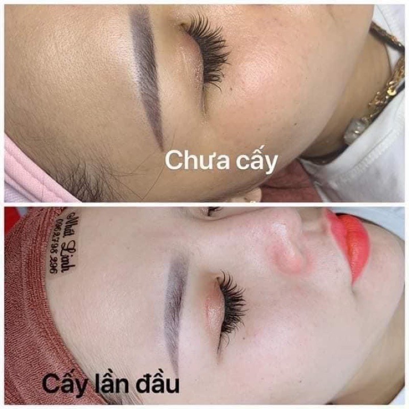 Nạ Yến _ Cấy Kim Cương Jang Won