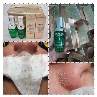 Ủ Mụn Đầu Đen - Mụn Cám Chuyên Dụng
