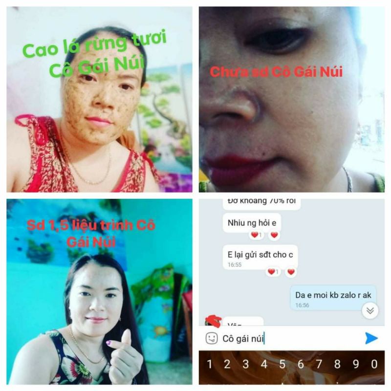 COMBO CAO LÁ RỪNG + KEM FACE SỮA