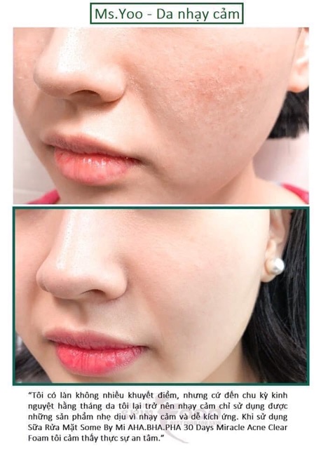 Sữa rửa mặt ngăn ngừa mụn AHA BHA PHA Some By Mi - Guu