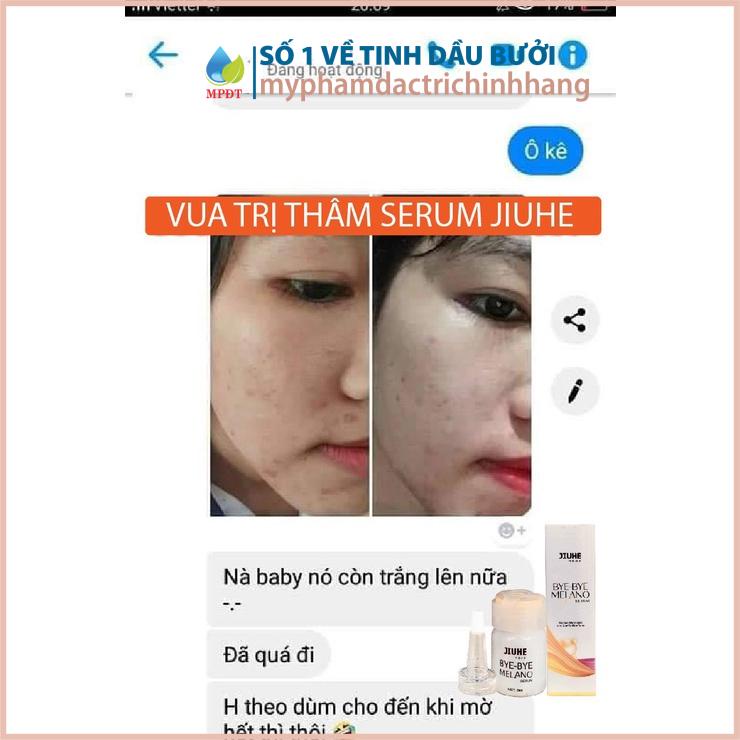 Serum xóa thâm Jiuhe 5ml skkh