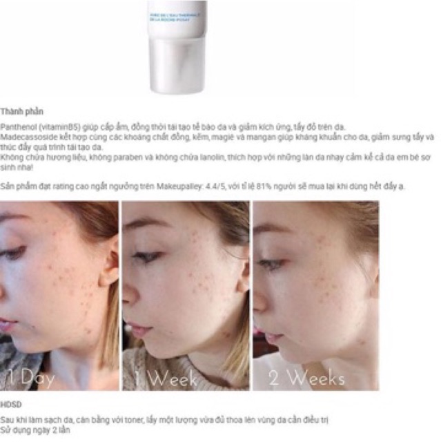 Kem phục hồi da La Roche-Posay Cicaplast Gel B5