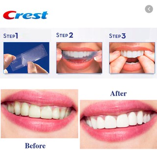 Dán trắng răng Crest 40 miếng
