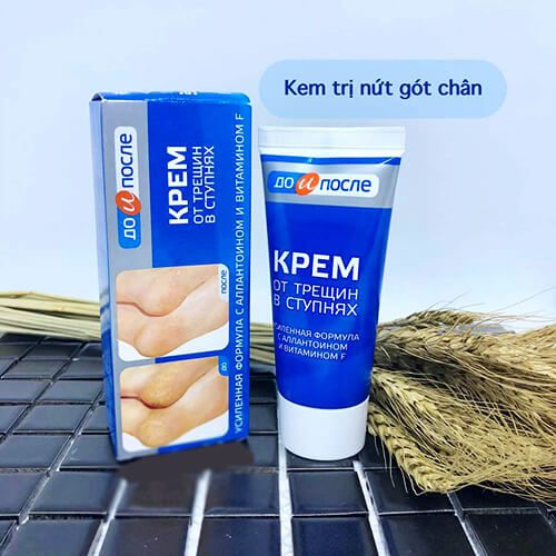 Kem  Nứt Gót Chân Kpem Apteka chính hãng Nga