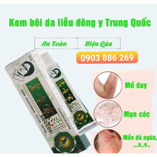 Kem bôi ngứa, ghẻ nước, nấm da, viem da, hắc lào, á sừng lâu năm