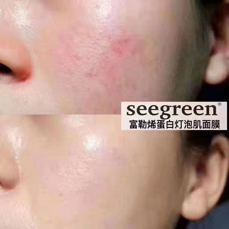 MẶT NẠ DƯỠNG TRẮNG DA CAO CẤP SEEGREEN | BigBuy360 - bigbuy360.vn