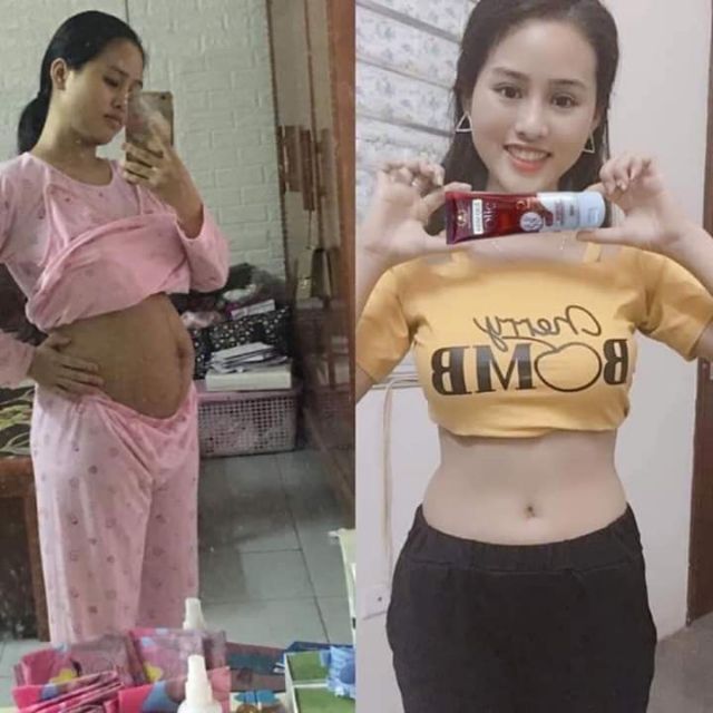 [Chính hãng-Date mới] COMBO 3 KEM TAN MỠ OLIC MẪU MỚI - KEM QUẾ OLIC - SĂN CHẮC QUẾ OLIC | BigBuy360 - bigbuy360.vn