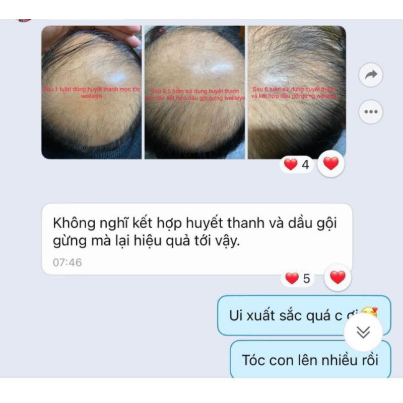 Bộ Dầu Gội - Xả Gừng Weilaiya Ngăn Rụng Tóc Kích Thích Mọc Tóc Chính Hãng