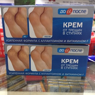 Kem trị nứt gót chân Kpem Apteka của Nga giữ ẩm làm mềm da