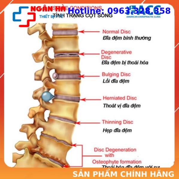 Đai treo xà đơn cho người - thoái hóa cột sống - đau lưng - thoát vị đĩa đệm