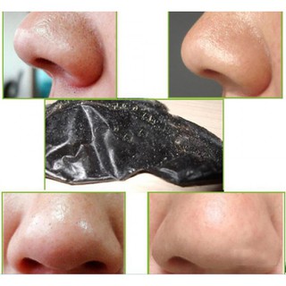 Miếng dán lột mụn Kose Softymo Nhật Bản