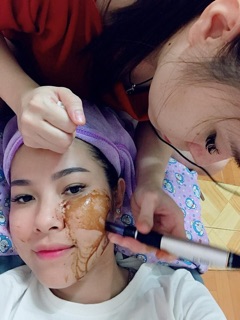 Cấy hồng sâm baby Hàn Quốc