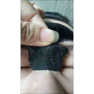 COMBO GEL lột mụn Lê Thanh