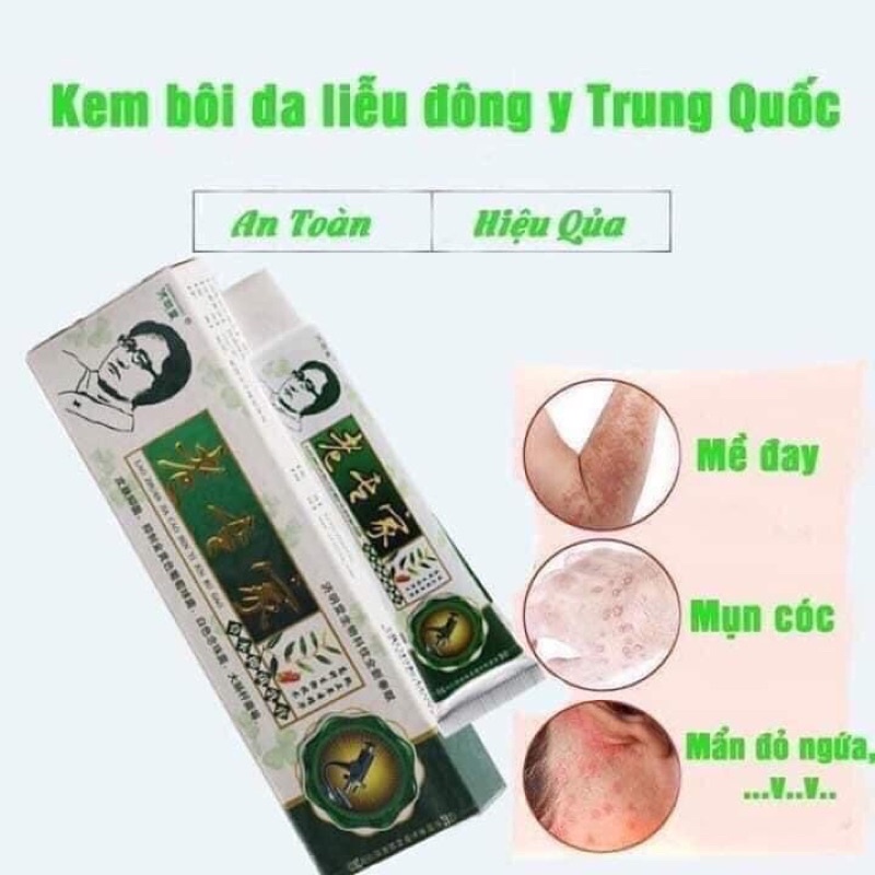 Kem Bôi Ngoài Da Chống Nứt Nẻ Bóng Tróc Cực Hiệu Quả Hàng Nội Địa Trung [ Kem Bôi Nẻ Vảy Nến]