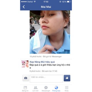Sụn Nâng Mũi