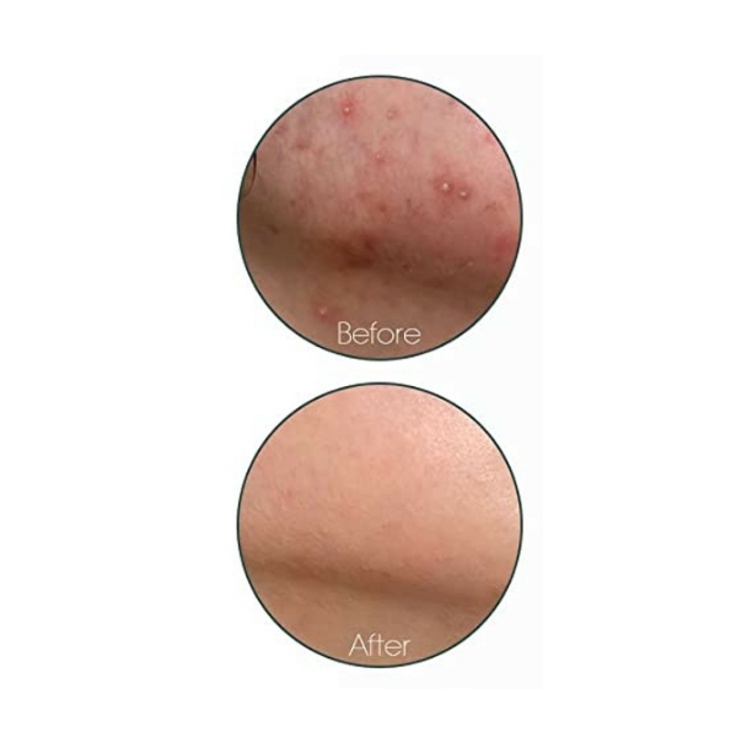 SOME BY MI Toner Aha Bha Pha Trong Vòng 30 Ngày 150ml / Serum 50ml