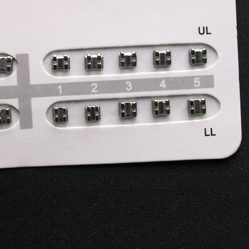 Niềng Răng Mini Chỉnh Hình Chăm Sóc Răng Miệng Bền Bỉ