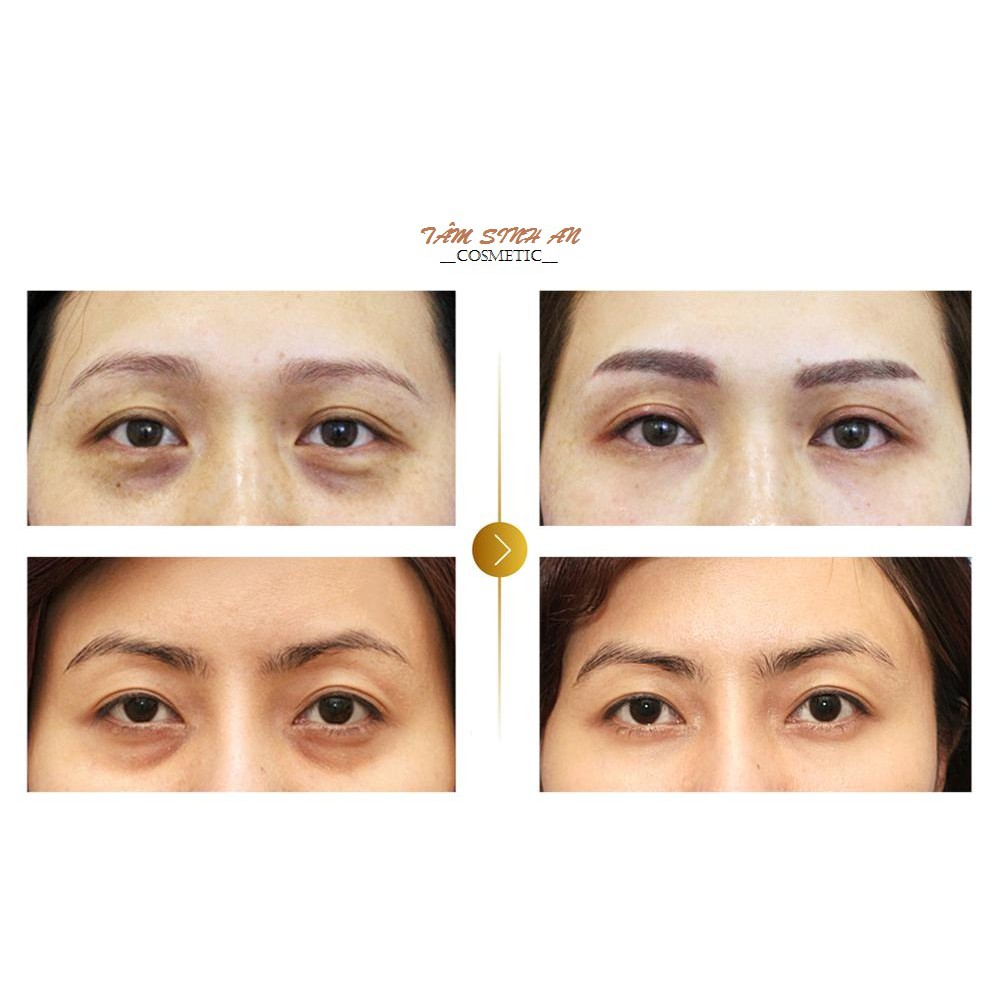 Kem Mờ Thâm Nách, Bẹn, Mông, Mụn, Quầng Mắt VERA - Công Dụng 7 Trong 1 - Tâm Sinh An Cosmetic - Mãi Mãi Tuổi 18 | BigBuy360 - bigbuy360.vn