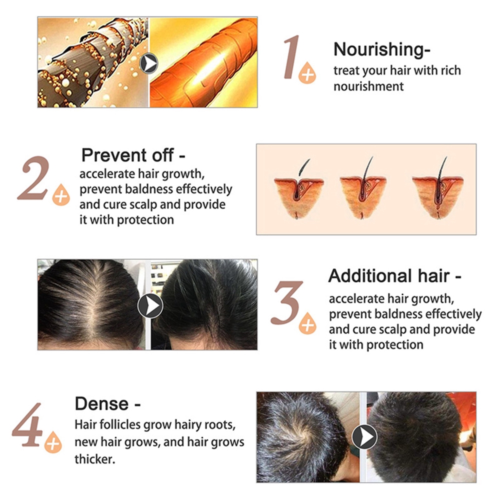 [Hàng mới về] Thuốc dưỡng tóc chống rụng tóc dung tích 30ml