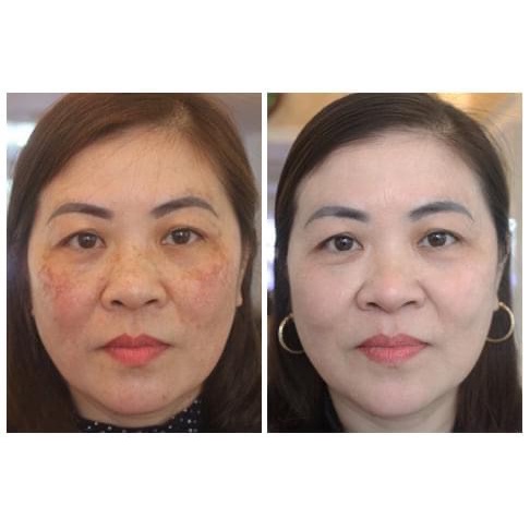 10 KEM COLLAGEN SỮA NON FEMMIU CHÍNH HÃNG