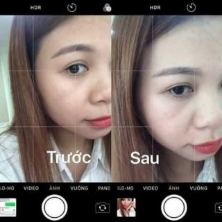 Kem nền BB
