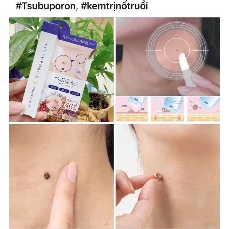 KEM GIẢM MỤN THỊT, MỤN RUỒI SUBUPORON EYE ESENCE NHẬT BẢN