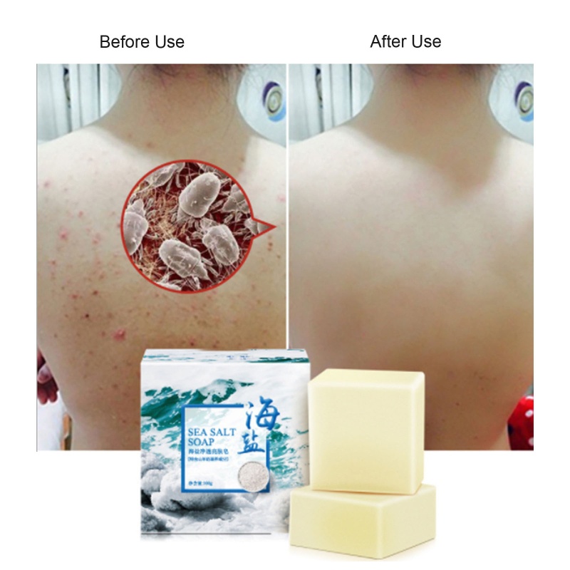 Xà Phòng Muối Biển Tẩy Tế Bào Chết Đa Năng YOUYO