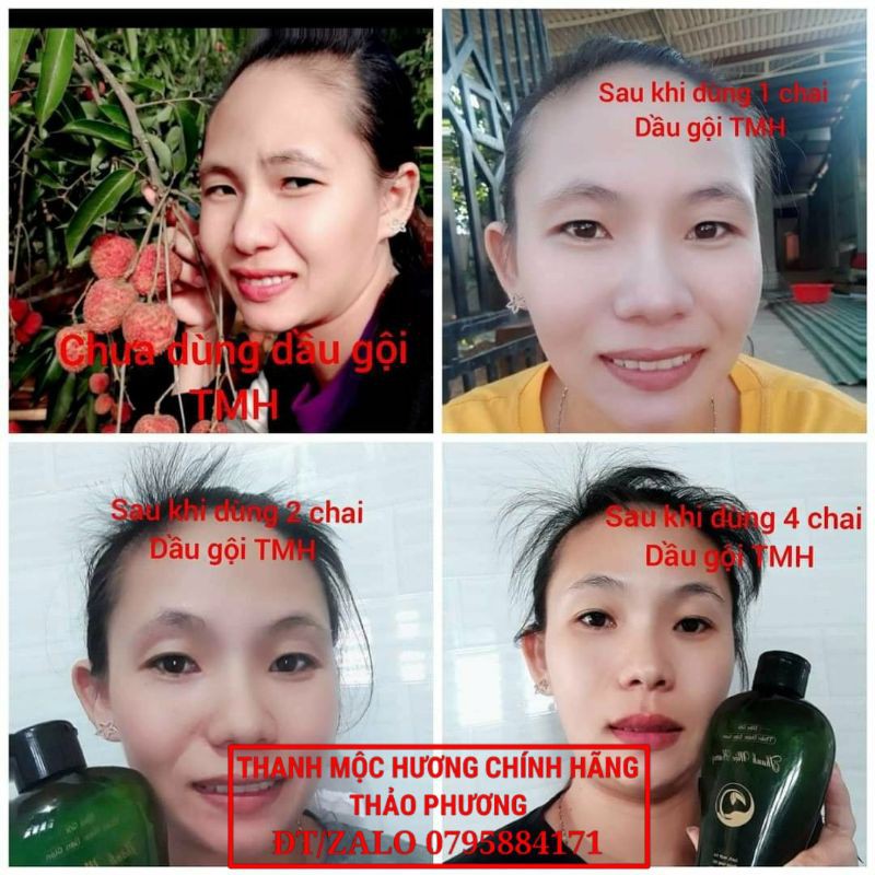 [1 GÓI] DẦU GỘI THANH MỘC HƯƠNG [CHÍNH HÃNG][GIÁ RẺ] | BigBuy360 - bigbuy360.vn