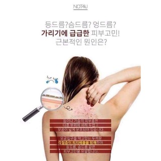 The Magic Clear Body Mist Chai Xịt Mụn Lưng