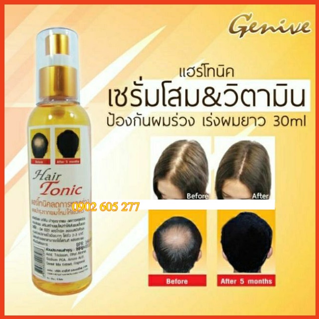 [Hàng chính hãng] Xịt mọc tóc Genive Hair Tonic Thái Lan