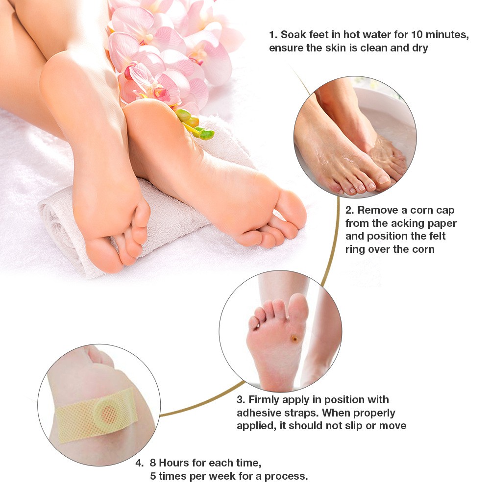 Miếng Dán Hỗ Trợ Giảm Mụn Cóc Vết Chai Chân Aliver