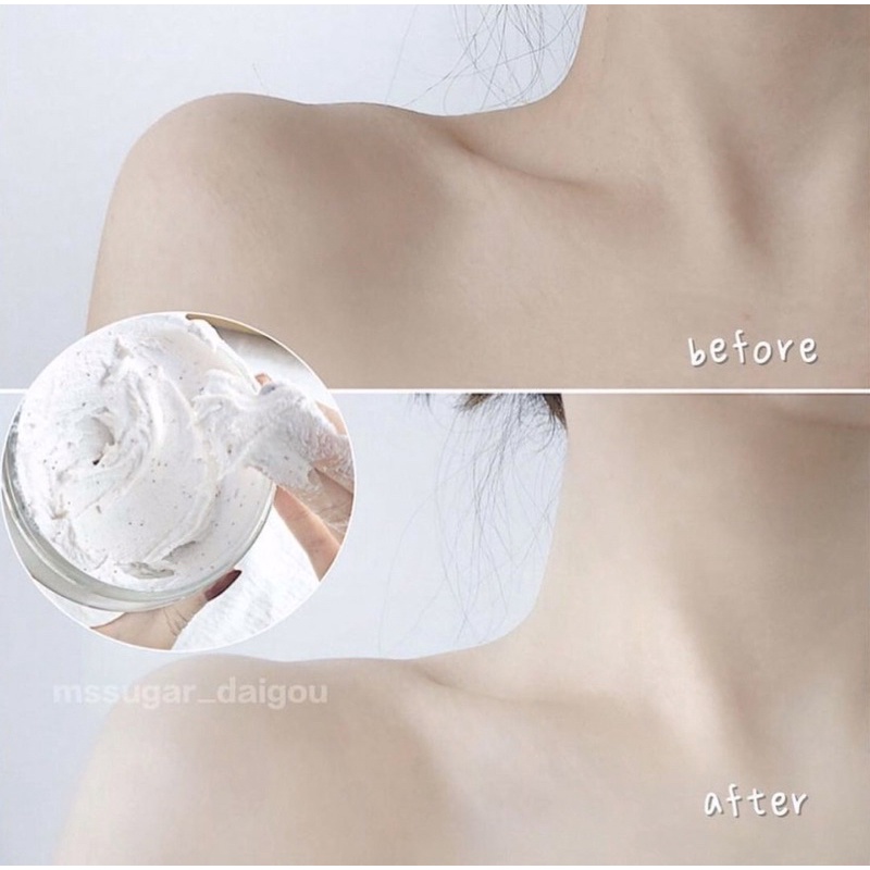 [BẢN ĐỨC] Tẩy da chết toàn thân Dove Exfoliating Body Scrub | BigBuy360 - bigbuy360.vn