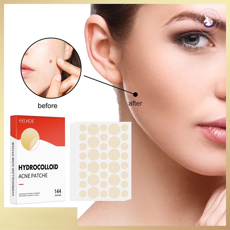 Miếng Dán Hấp Thụ Hydrocolloid Chăm Sóc Da Mặt Vô Hình
