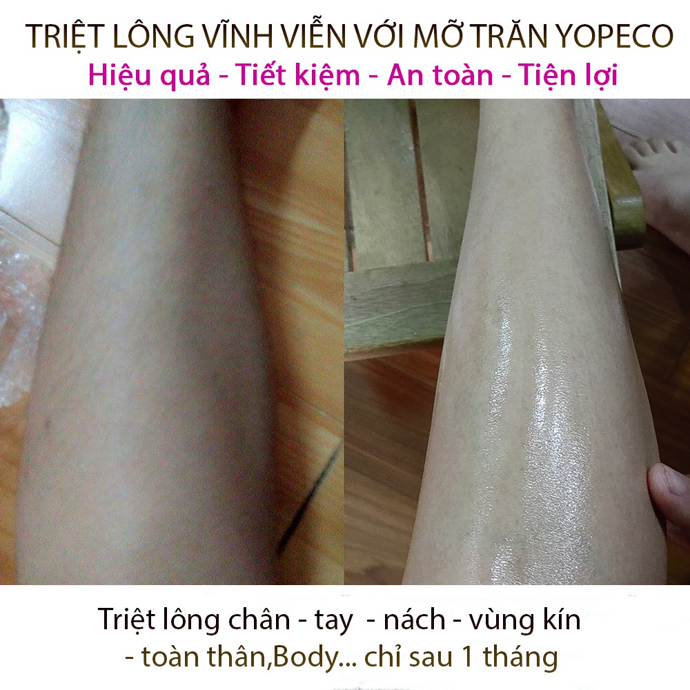 Mỡ Trăn Yopeco triệt lông giảm bỏng làm mờ sẹo dưỡng trắng da hiệu quả 100ml 100% nguyên chất | BigBuy360 - bigbuy360.vn