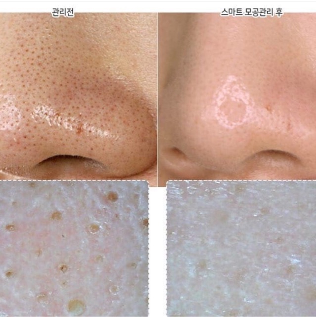 Sữa Rửa Mặt Innisfree Jeju Volcanic Pore Cleansing Foam