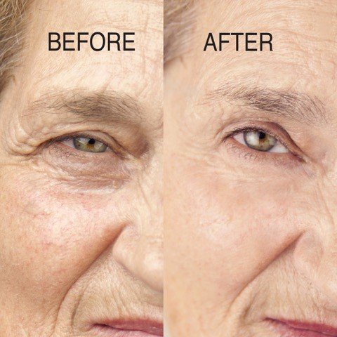 Serum Chống Lão Hóa Retinol Advanced Clinicals Anti-Wrinkle 52 ml