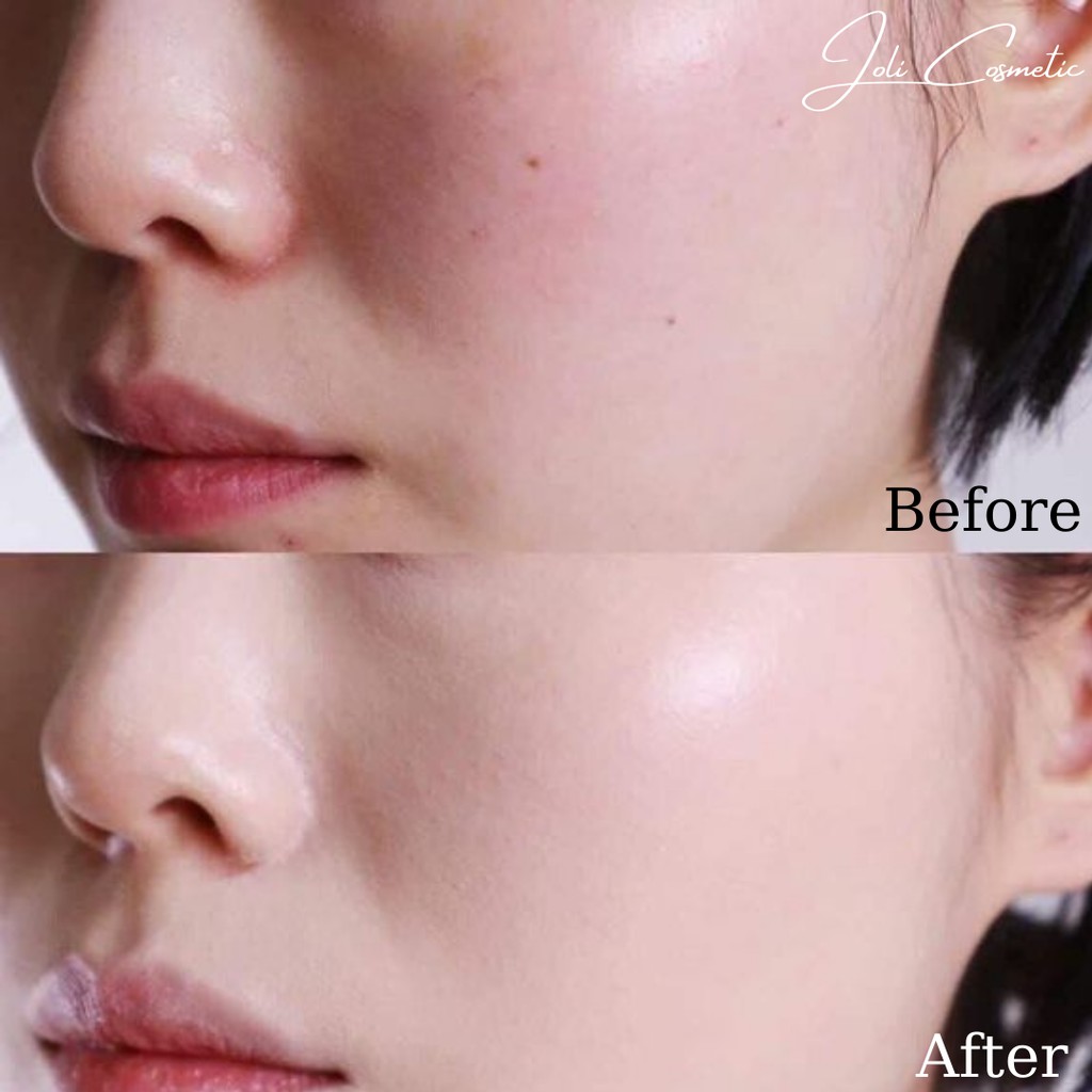 Kem chống nắng SJM Medical Anti UV Perfect SunScreen SPF50+/PA++++ - Nâng tone cấp ẩm phù hợp cho mọi loại da | BigBuy360 - bigbuy360.vn