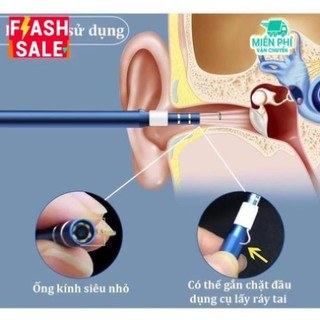 Camera nội soi lấy ráy tai
