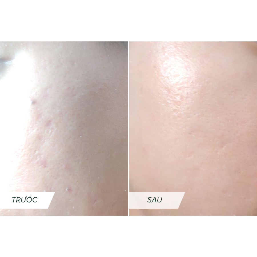 Bộ sản phẩm chăm sóc da cao cấp PC