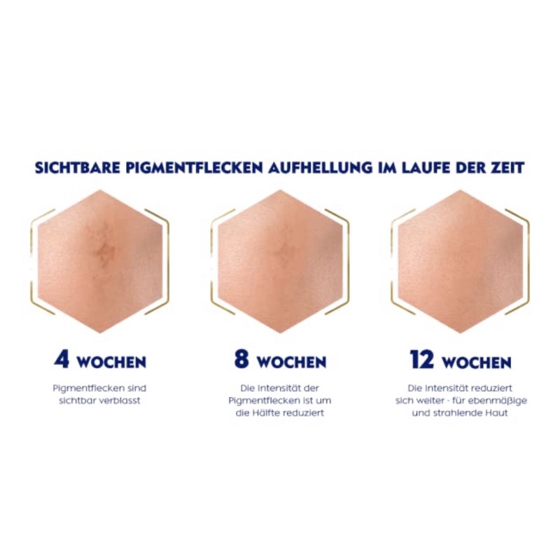 Bộ dưỡng xoá nám sạm hiệu quả