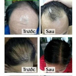 Dầu gội dân gian Thanh Mộc Hương (chính hãng)