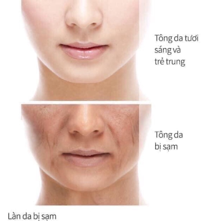Kem dưỡng trắng da Sulwhasoo bạch sâm dưỡng trắng da mờ thâm nám 5ml