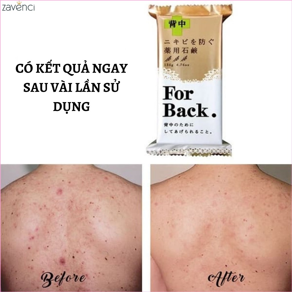 Xà phòng trắng da FOR BACK Pelican Medicated Soap ngừa mụn lưng 135g - ZAVENCI Official | BigBuy360 - bigbuy360.vn