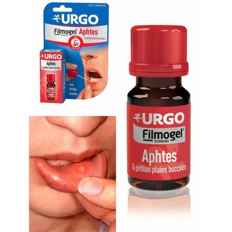 Gel lỡ miệng Urgo Filmogel Mouth ulcer-Thúc đẩy lành vết loét - Chai 6ml