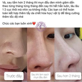1612 Thanh lăn giảm mụn đầu đen Neogen Canadian Clay Pore Stick mask W368