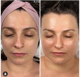 Serum Vitamin C Esthemax sáng da 100ml